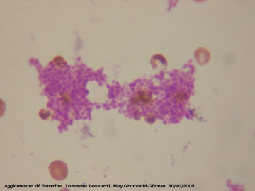 Platelets Smear.jpg