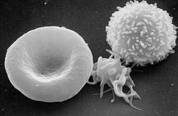 PRP RBC Platelet WBC.jpg